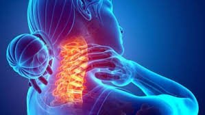 دیه شکستن گردن