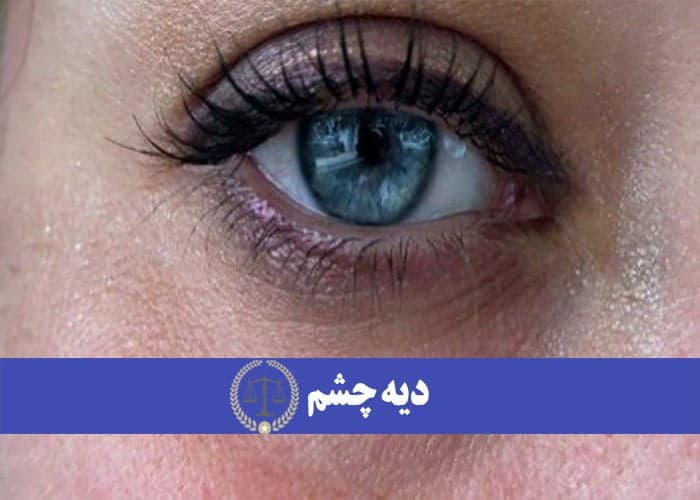 دیه چشم